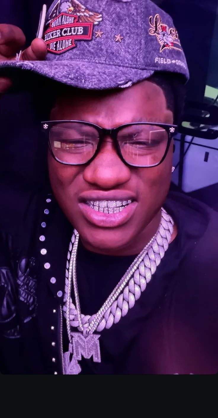 A GoldMoufDog customer wearing a custom grill and chain